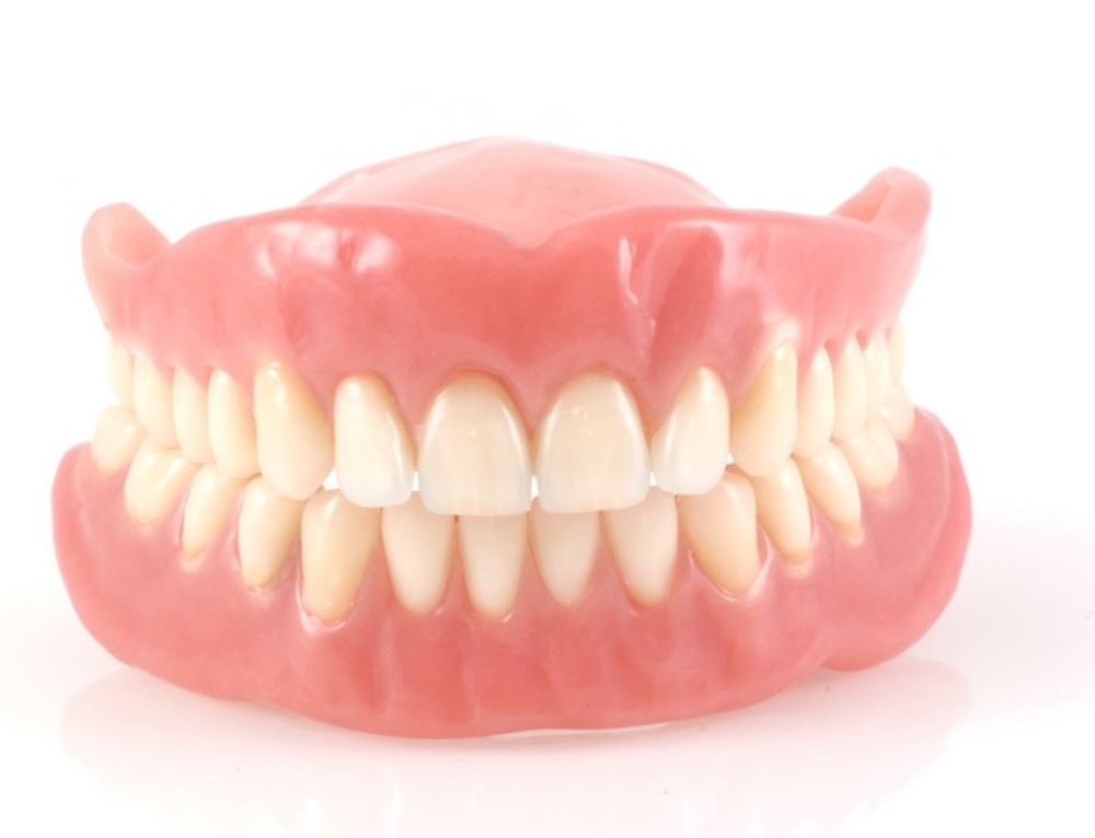 Cobalt Chrome Denture Sunrise Dental Lab