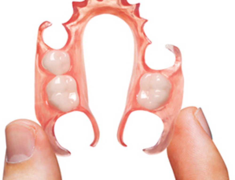 Cobalt Chrome Denture Sunrise Dental Lab